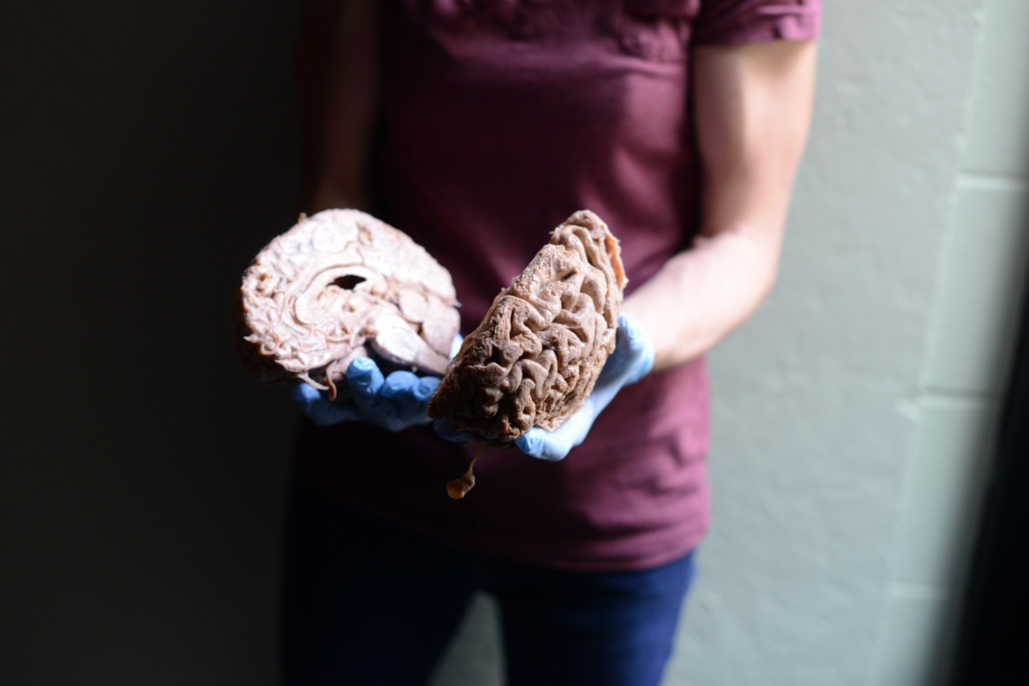 human brain
